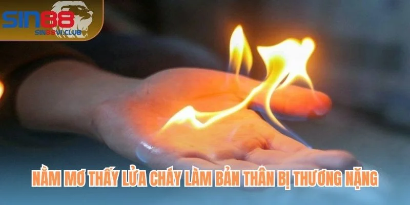 Nằm mơ thấy lửa cháy làm bản thân bị thương nặng